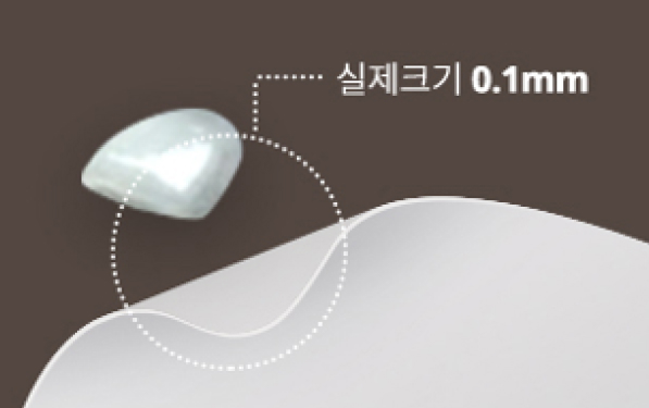 무삭제 라미네이트03