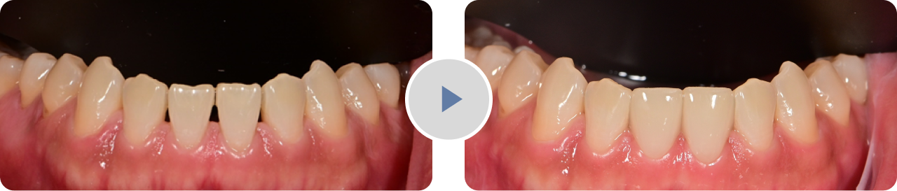블랙트라이앵글01