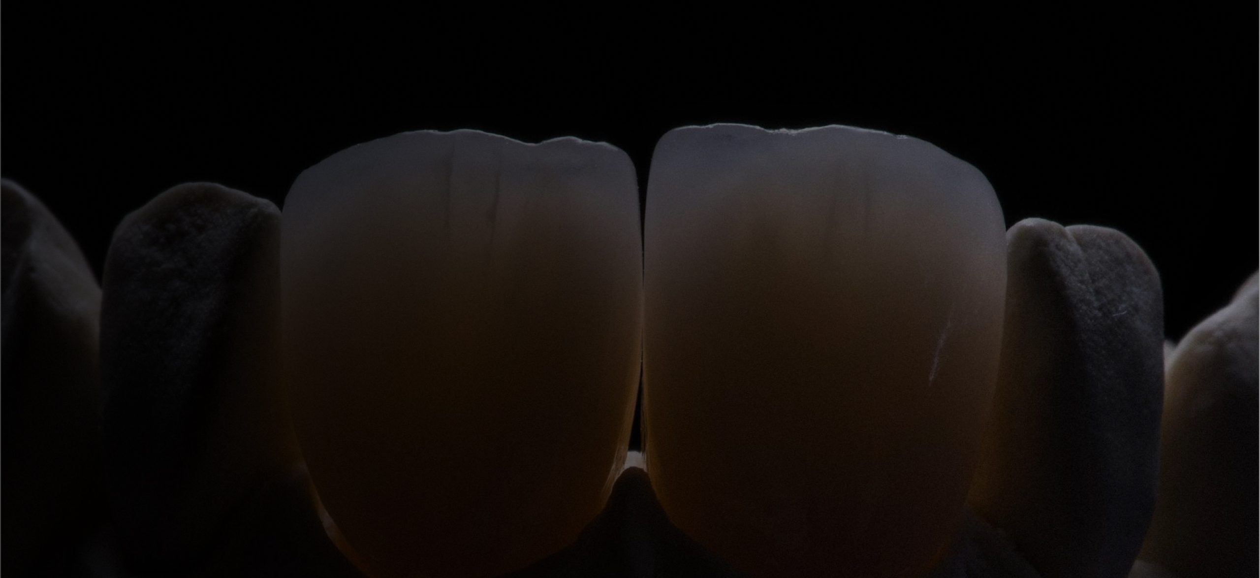 디테일이 만든 프리미엄 라미네이트