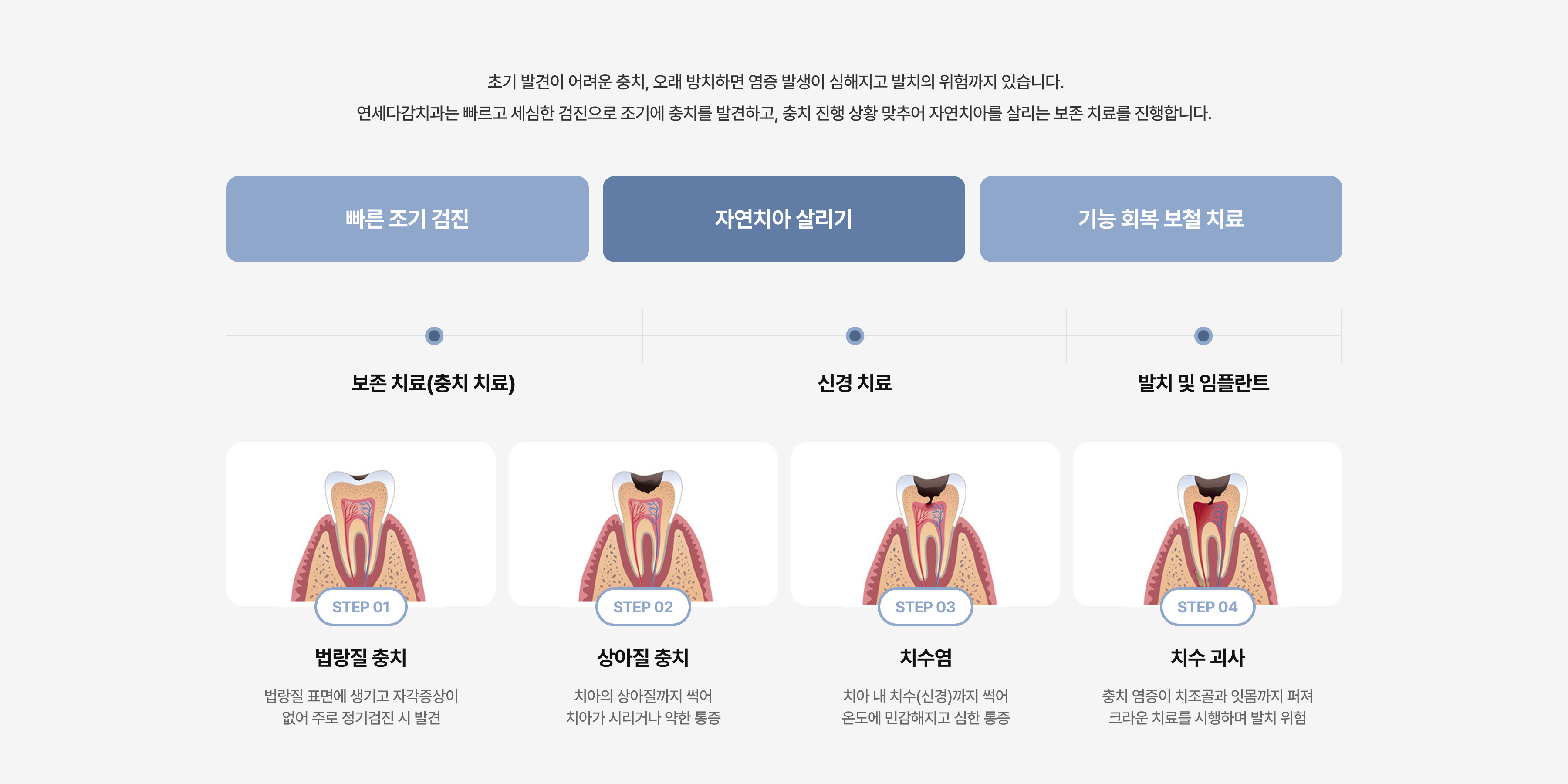 자연치아 살리기 치료2