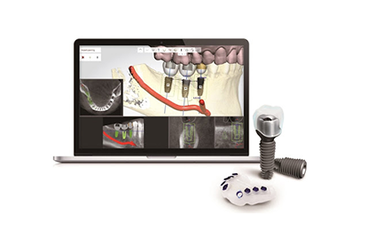 네비게이션 모의 수술